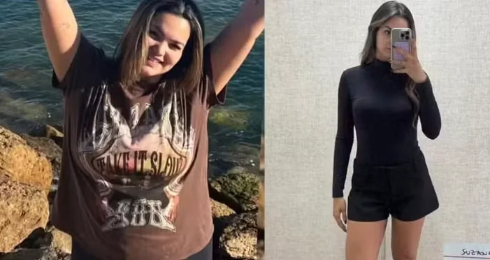 Exemplo de antes e depois de emagrecimento